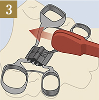 3