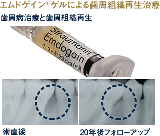 再生スピードを上げるたんぱく質で再生誘導