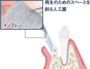 再生スピードを上げるたんぱく質で再生誘導