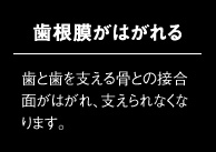歯根膜がはがれる